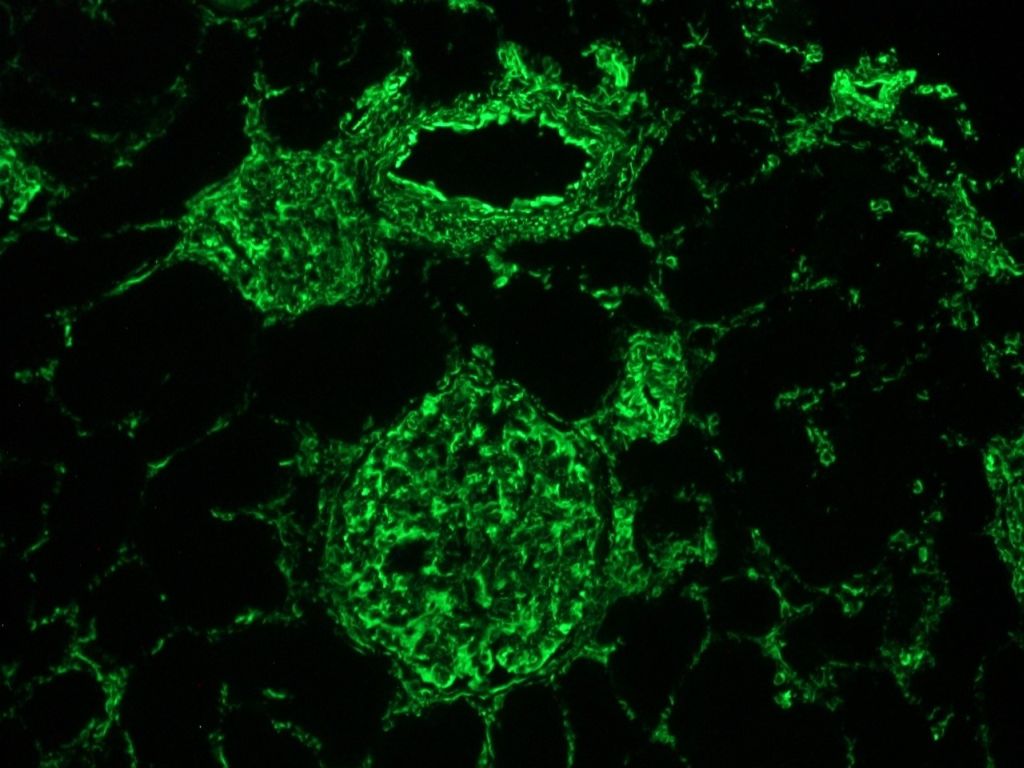 Indirect immunofluorescence staining of human kidney frozen section with MUB1902P (clone V9). Note positive vimentin staining in glomeruli and connective tissue, but not in the epithelial ducts.